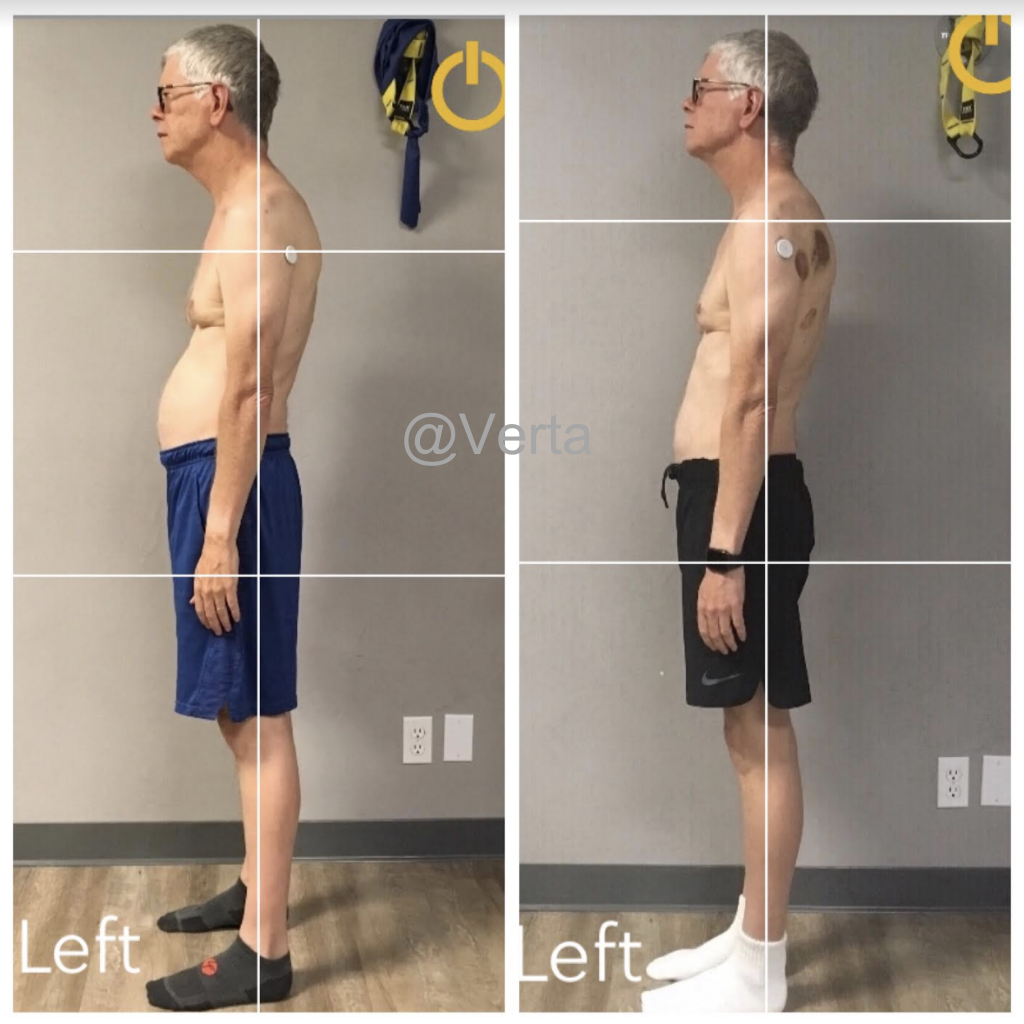 Older man side profile showing posture realignment after using Verta